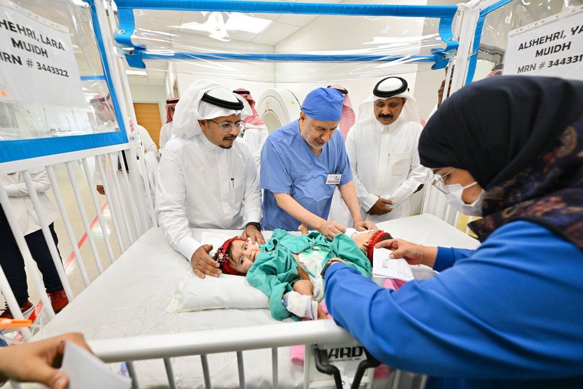بدء عملية فصل التوأم الملتصق السعودي.. صور