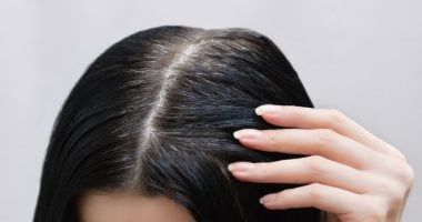 فيتامينات ومعادن ضرورية تدعم نمو الشعر وصحته