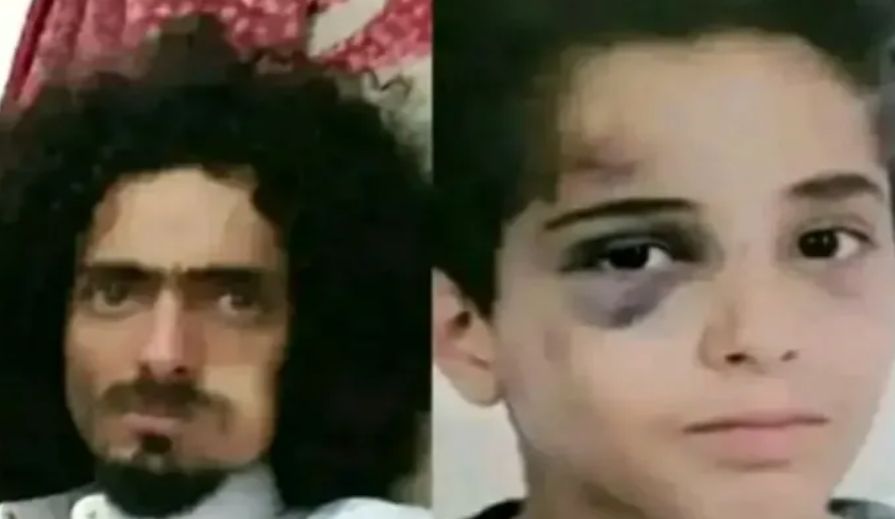 هزت العاصمة صنعاء...من هم آل بادي؟.. القصة وراء اعتداء وحشي على طفل
