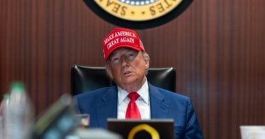 ترامب يعاني من قصور وريدي مزمن.. كل ما تريد معرفته عن المرض