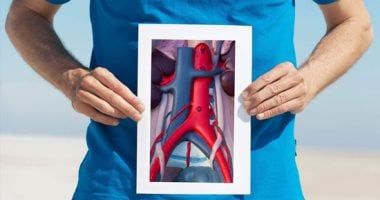 بلاش توتر واشرب مياه.. طرق الوقاية الفعالة من توسع الأوعية الدموية الشائع