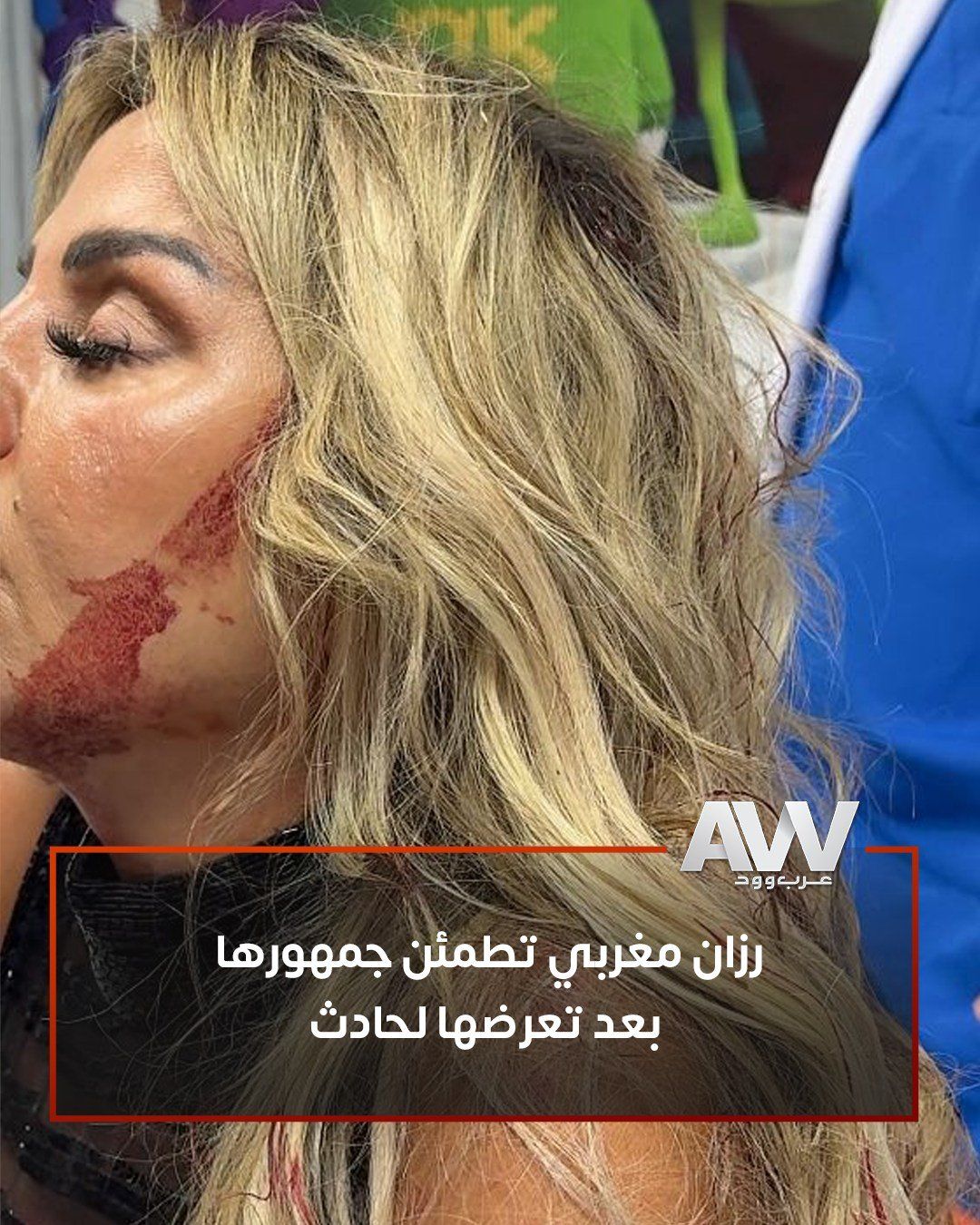 رزان مغربي تطمئن جمهورها بعد إصابة الرأس.. ودنيا سمير غانم تدعو لها