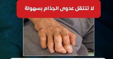 وزارة الصحة: عدوى الجذام لا تنتقل بسهولة واللمس لا يصيب بالعدوى