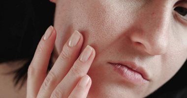 مسام جلدك واسعة.. اعرفى الأضرار وطرق العلاج الفعالة