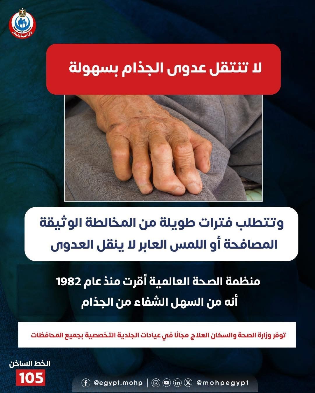 وزارة الصحة: عدوى الجذام لا تنتقل بسهولة واللمس لا يصيب بالعدوى