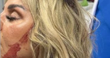 رزان مغربي في أول تصريح بعد الإصابة: "قدر الله وما شاء فعل"