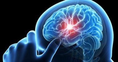 أسباب تكون جلطات الدم في الدماغ وعلاماتها التحذيرية وطرق الوقاية