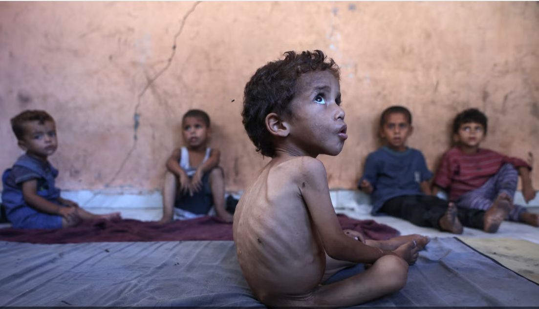 الذهب مقابل رغيف العيش.. 80 طفلا فى غزة ماتوا من الجوع