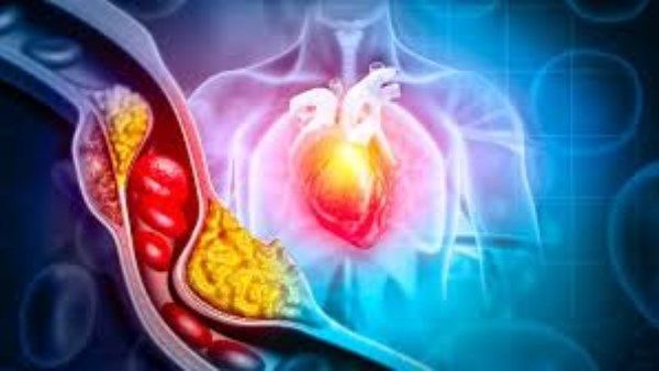 بشكل طبيعي...5 فواكه تقلل الكوليسترول في الجسم