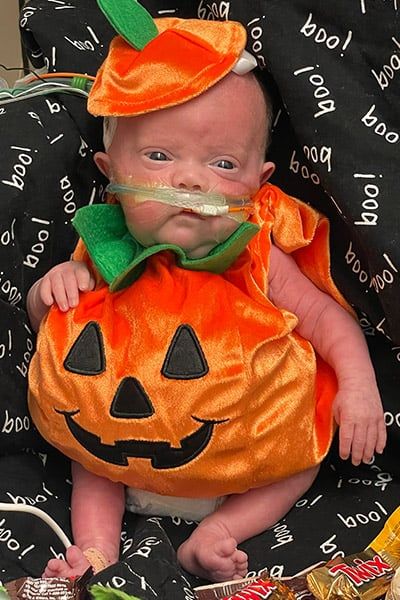 مولود أد الصابونة.. طفل مبتسر يدخل موسوعة جينيس فى عيد ميلاده الأول "فيديو"