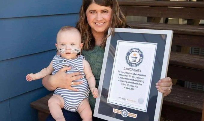 مولود أد الصابونة.. طفل مبتسر يدخل موسوعة جينيس فى عيد ميلاده الأول "فيديو"