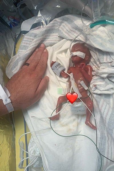 مولود أد الصابونة.. طفل مبتسر يدخل موسوعة جينيس فى عيد ميلاده الأول "فيديو"