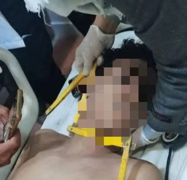 وفاة مأساوية لفتى في إب: "معالج بالقرآن" يعذبه حتى الموت خلال "رقية شرعية"