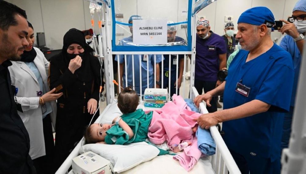 صور| بدء عملية فصل التوأم السيامي السوري "سيلين وإيلين"