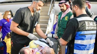 تمت بنجاح.. انتهاء ثاني مراحل فصل التوأم الملتصق السوري سيلين وإيلين في السعودية