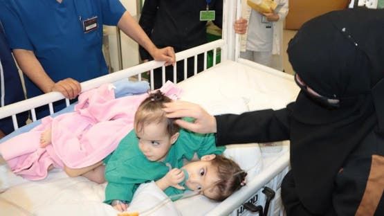 السعودية تبدأ فصل توأم سوري ملتصق بعملية جراحية دقيقة في الرياض