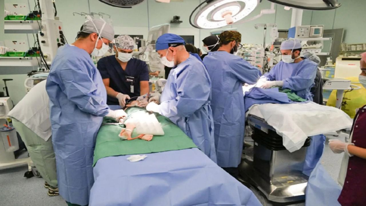 نجاح عملية فصل التوأم الملتصق السوري “سيلين وإيلين”