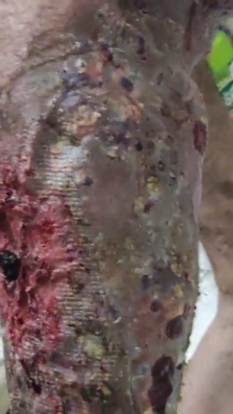 "بيموت بالبطيء".. محمد شوقي يُصارع مرضًا مناعيًا نادرًا ويحتاج لعلاج