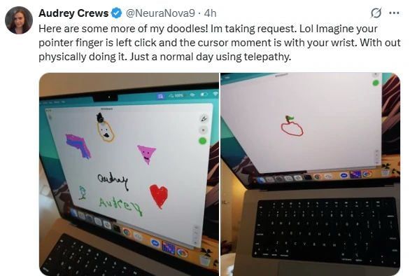 تكنولوجيا: بعد 20 سنة من الشلل.. امرأة تكتب اسمها عبر شريحة إيلون ماسك الدماغية