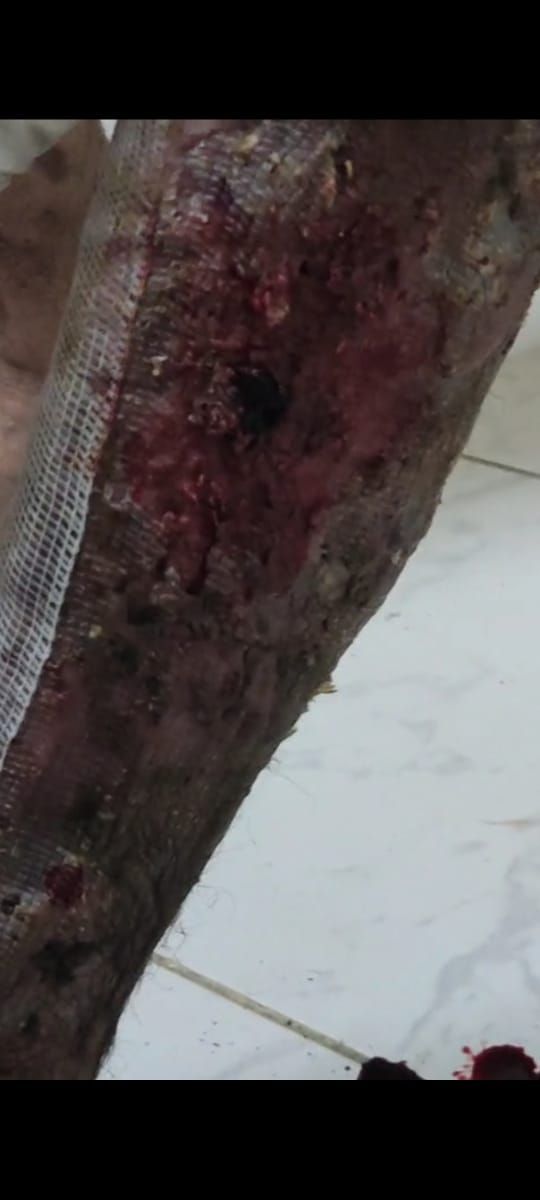 "بيموت بالبطيء".. محمد شوقي يُصارع مرضًا مناعيًا نادرًا ويحتاج لعلاج
