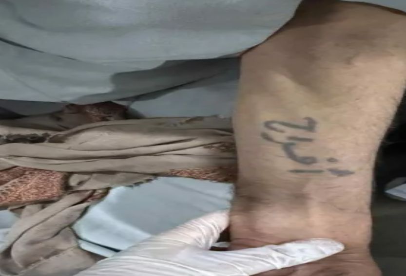 منذ ثلاثون عامًا...وشم على يد سبعيني في صنعاء يفاجئ طبيبة الطوارئ لتكتشف قصة حب