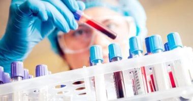 دراسة تكشف عن علامة تحذير مبكرة لسرطان البنكرياس