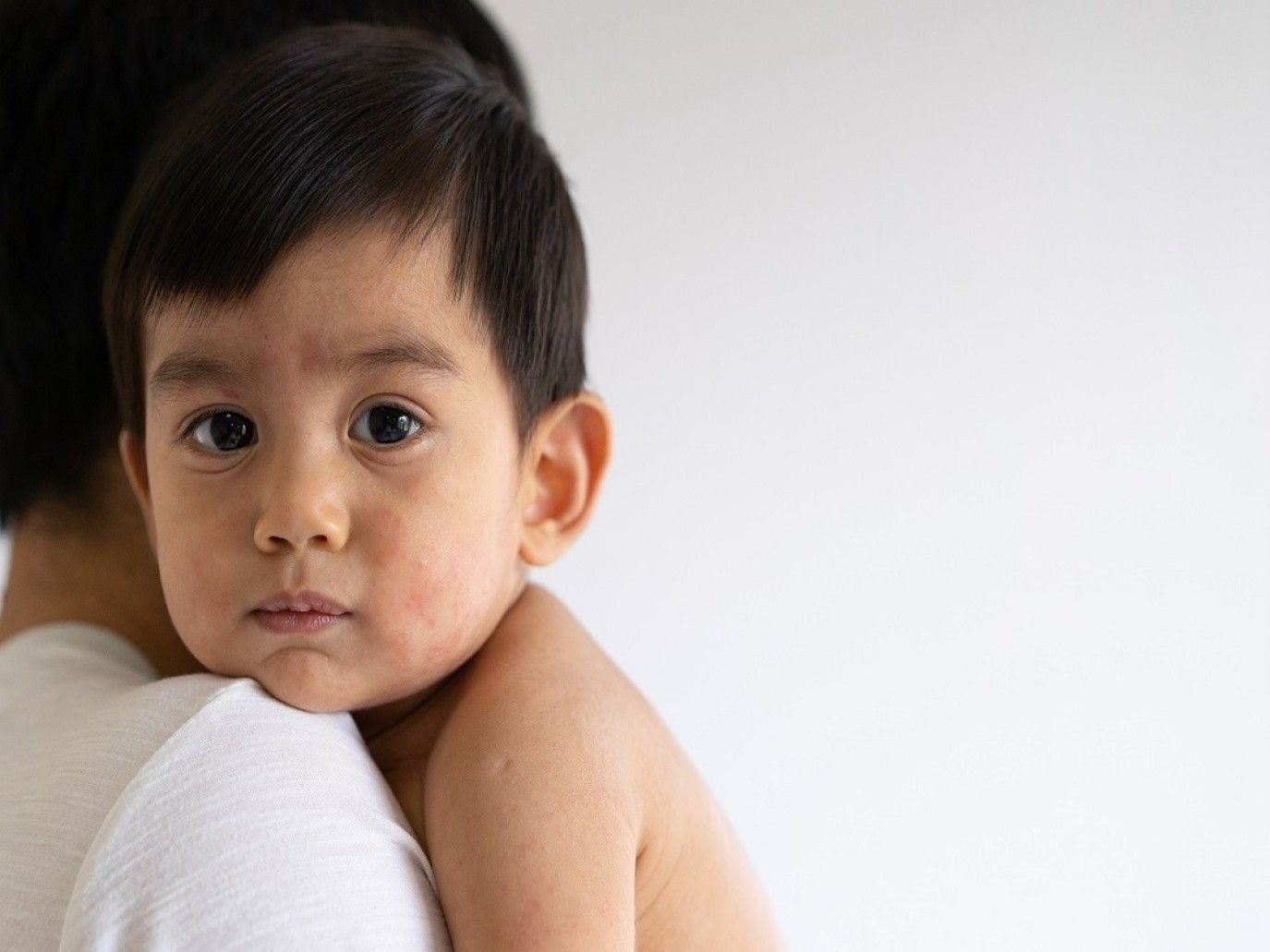 دليلك للتفريق بين الحساسية الغذائية عند طفلك و متلازمة الحساسية الفموية