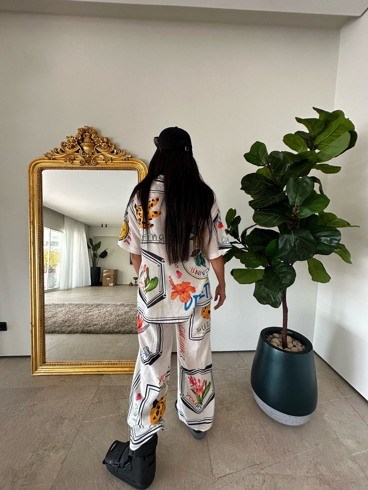 بالصور- إصابة في الساق لا تُوقفها… غادة عبد الرازق نجمة الصيف رغم الألم