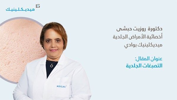 التصبغات الجلدية أسبابها وعلاجها