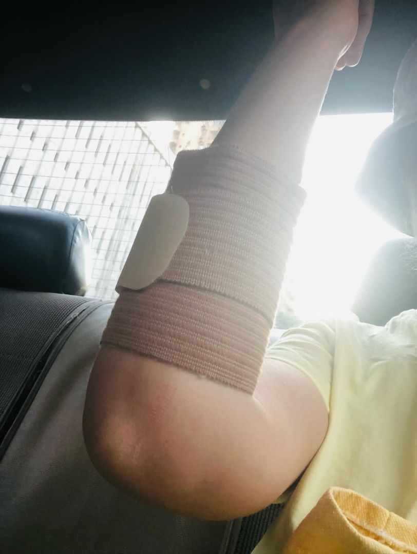 إصابة جديدة تتعرض لها رحمة حسن بعد سقوط شعرها.. أعرفوا تفاصيلها