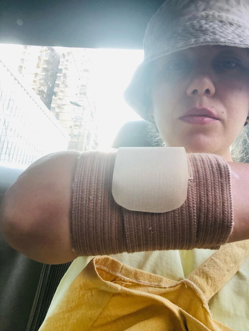 إصابة جديدة تتعرض لها رحمة حسن بعد سقوط شعرها.. أعرفوا تفاصيلها