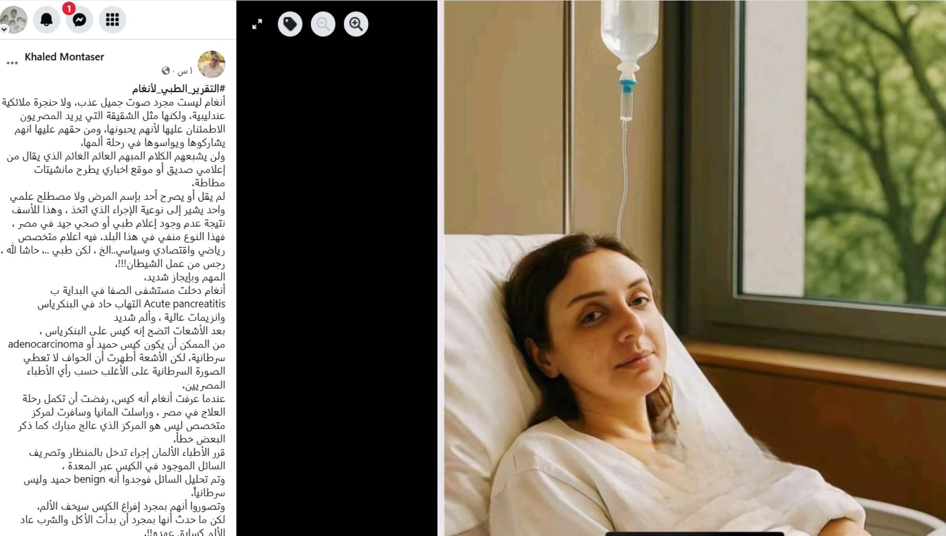 أول تقرير طبي عن أنغام: خالد منتصر يكشف سبب حيرة الأطباء في ألمانيا