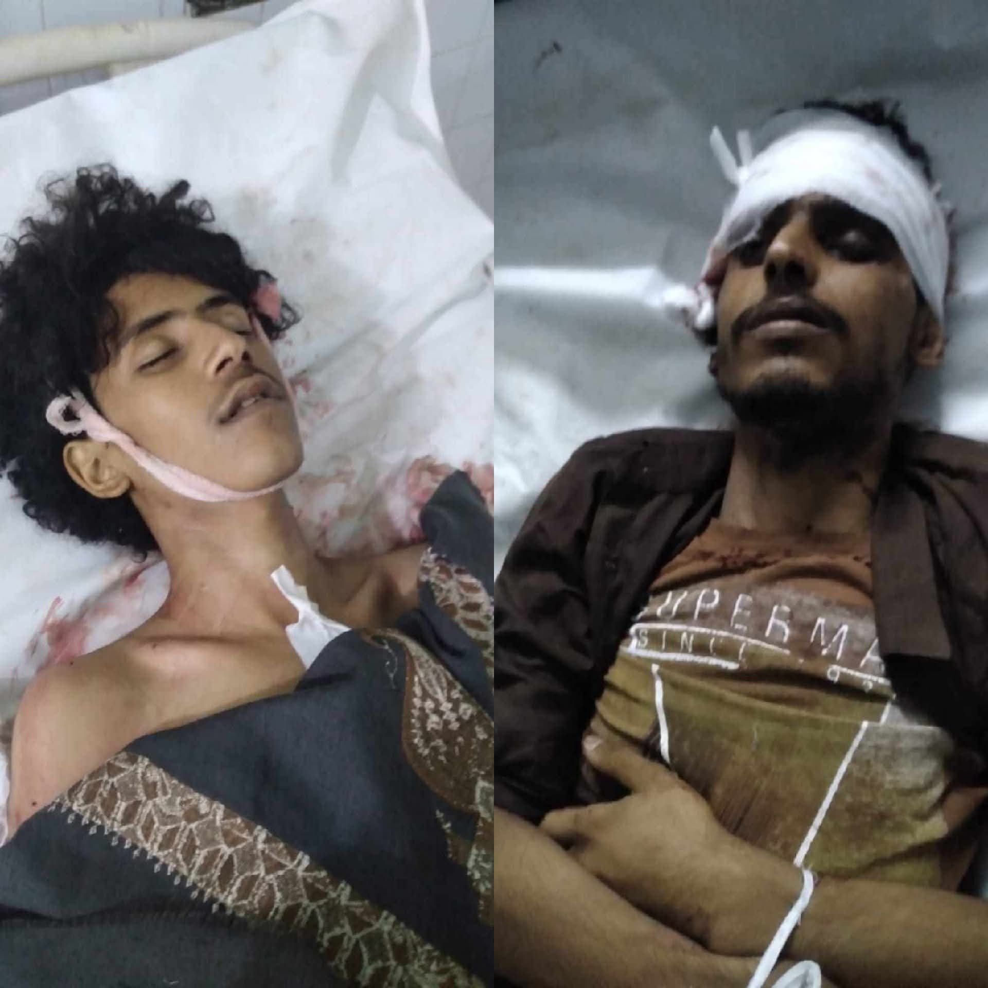 صديقان يقتلان بعضهما بسبب "القات"(صورة)