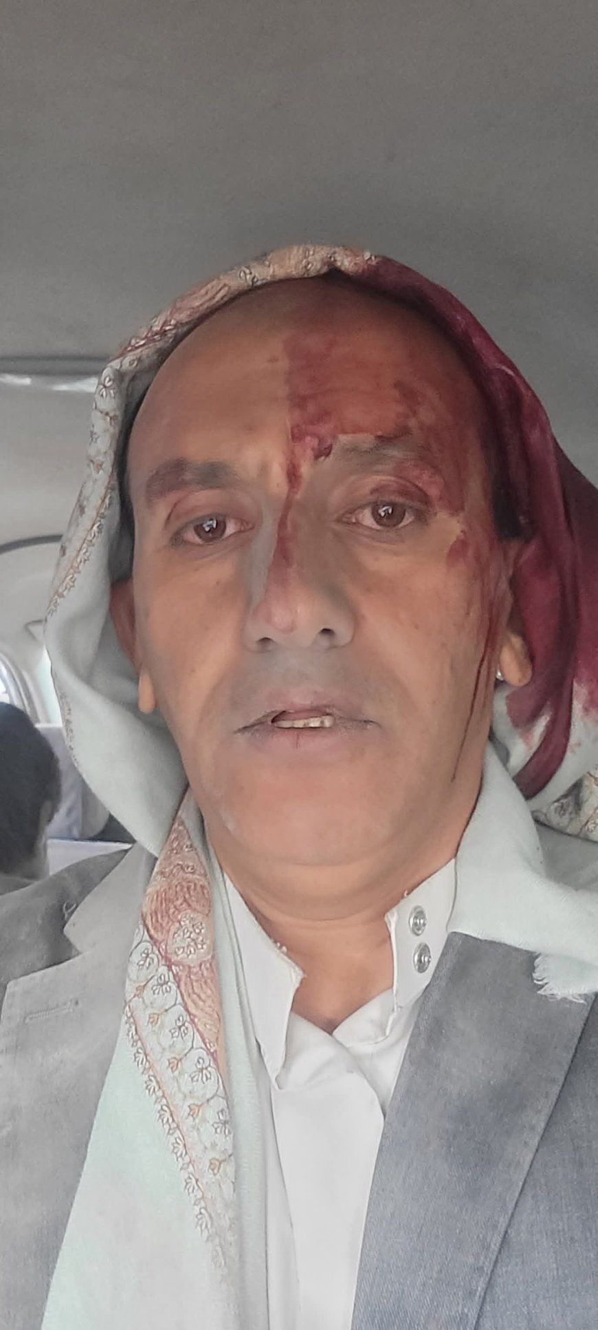 عاجل:اول ظهور لصحفي بارز ينجو من موت محقق خلال القصف الإسرائيلي على مقر صحيفة "26 سبتمبر"(صورة أولية)