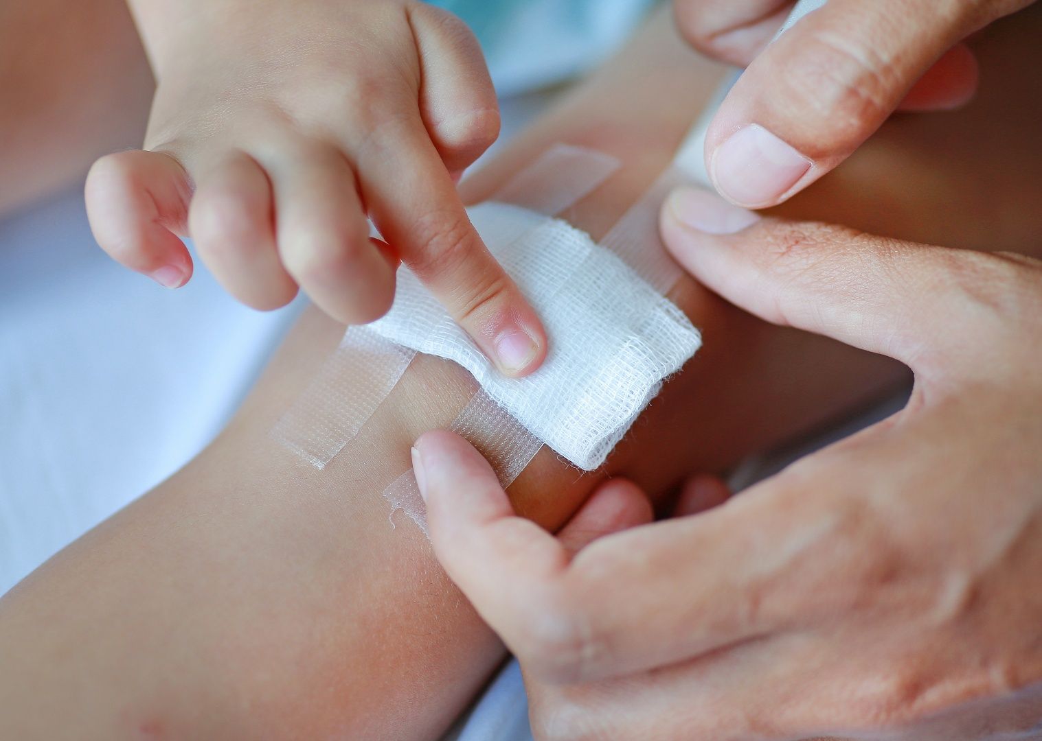 علاج حروق طفلك في المنزل.. إسعافات أولية وأخطاء تجنبيها