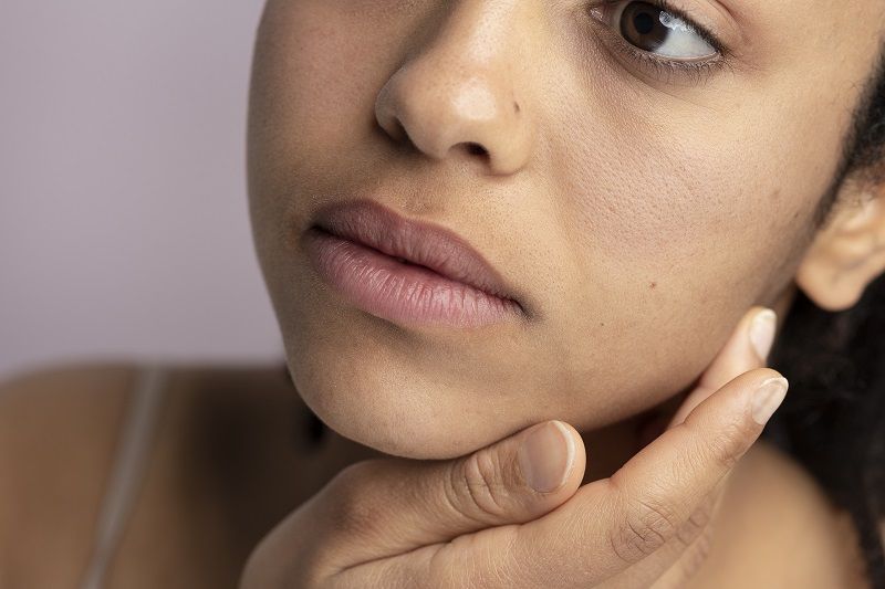 اسمرار البشرة حول الفم: تعرفي إلى أسبابه وطرق التخلص منه نهائياً