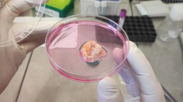 «أبوظبي للخلايا الجذعية» يطلق علاجاً مبتكراً للسرطان