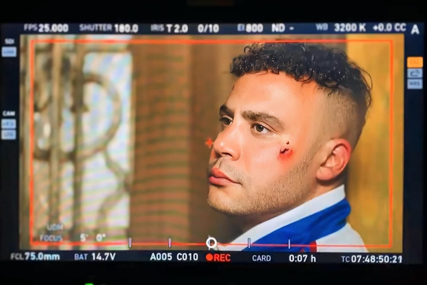 بالصّور- إصابات وغموض في أولى صور محمّد إمام من “الكينج”