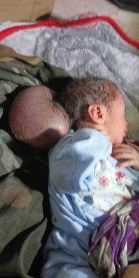 مناشدة لإنقاذ طفل مولود في عدن