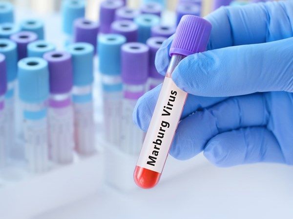 إثيوبيا تعلن تفشي وباء "ماربورغ"