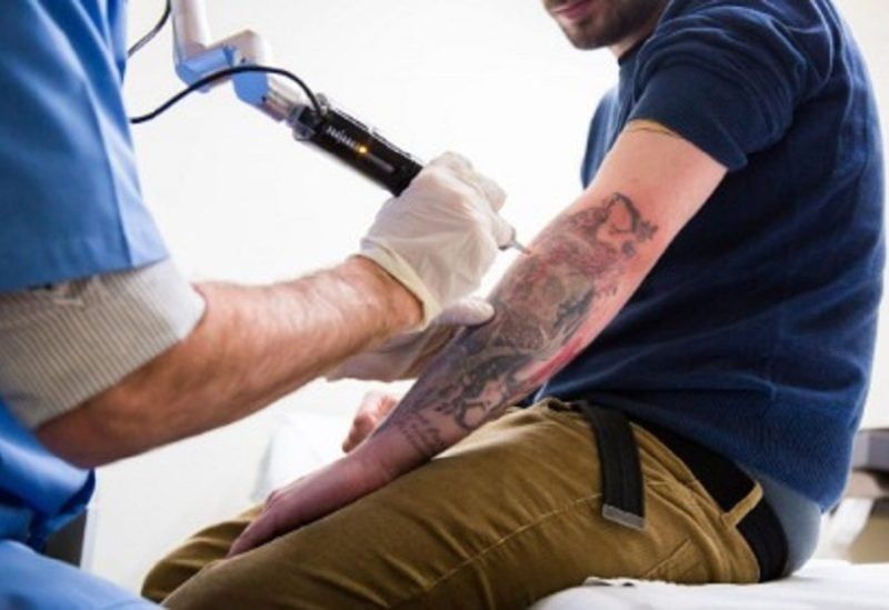 دراسة حديثة: الوشم يزيد خطر الإصابة بسرطان الجلد بنسبة 29%