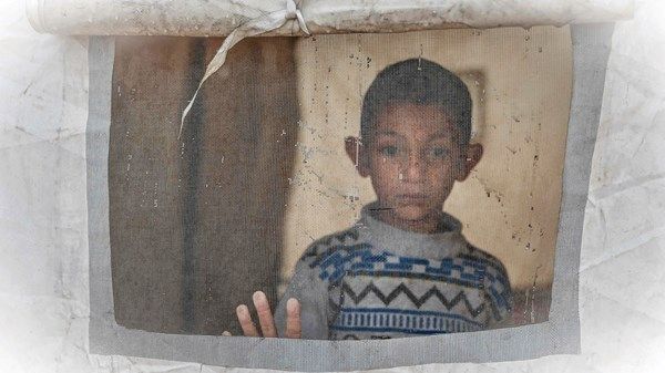 «إعاقات الأطفال».. مأساة إنسانية متفاقمة في غزة