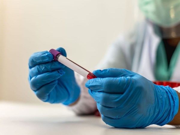 علماء ينجحون في تصنيع مركب فطري واعد ضد السرطان