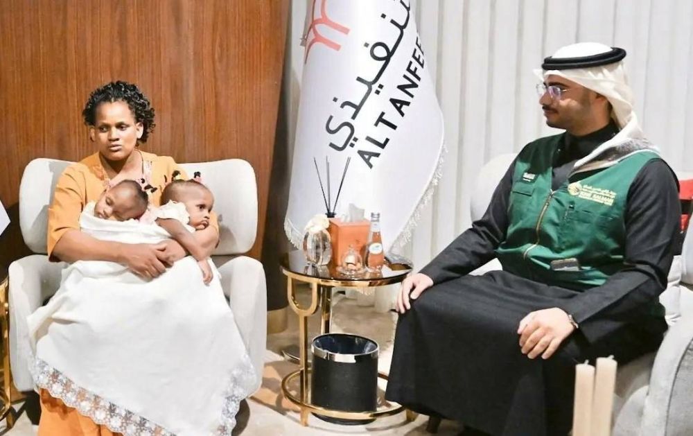 وصول التوأم الملتصق التنزاني إلى الرياض