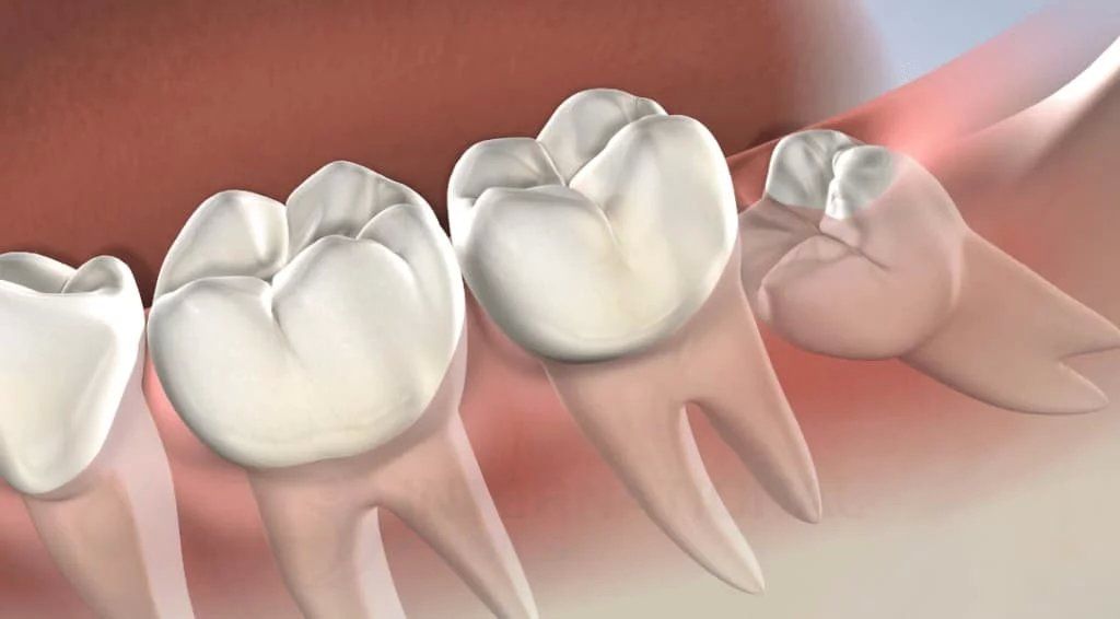 افضل دكتور خلع اسنان في جدة
