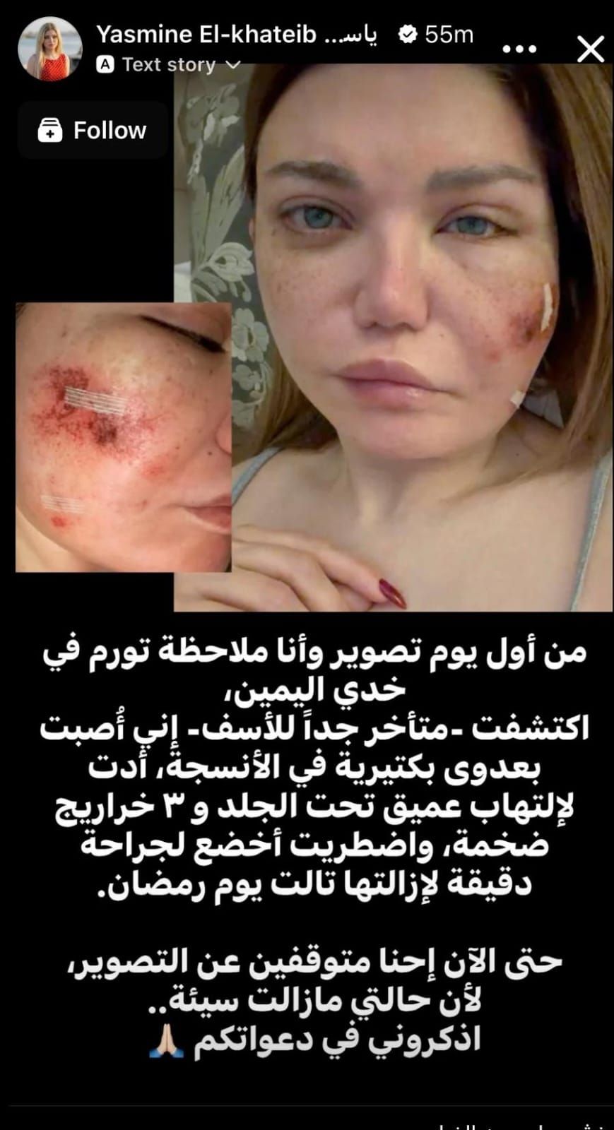 عدوى خطيرة تُبعد ياسمين الخطيب عن الشاشة… وقف التصوير ورسالة مؤثرة للجمهور