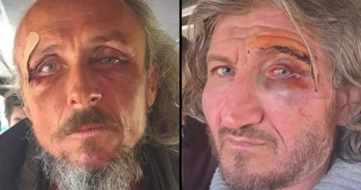 بالصور: تعذيب وعنف من الجيش الإسرائيلي بحق مشاركين في "أسطول غزة"
