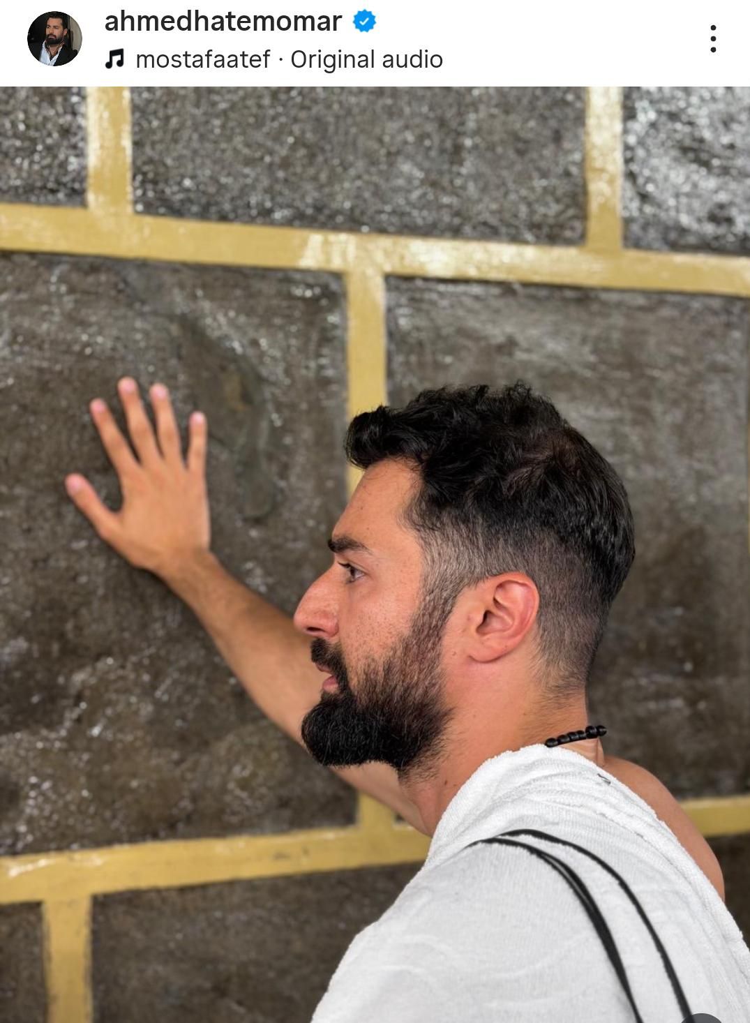 أحمد حاتم يتعرّض لإصابة خلال رحلة الحج.. ماذا حدث معه بالصور؟