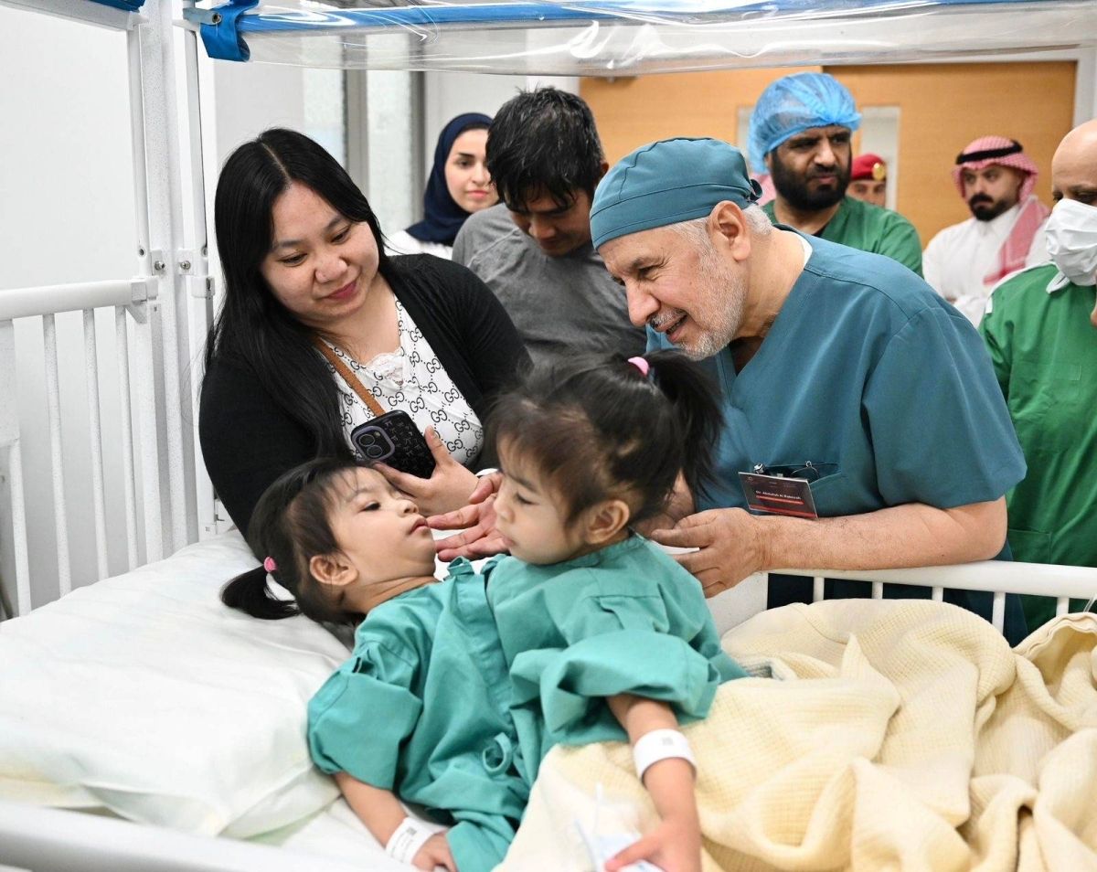 إنفاذًا لتوجيهات خادم الحرمين الشريفين وولي العهد.. بدء عملية فصل التوأم الملتصق الفلبيني (أوليفيا وجيانا)