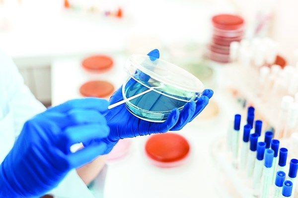 أبحاث تستكشف دور الذكاء الاصطناعي في تشخيص التَّصلب المتعدّد